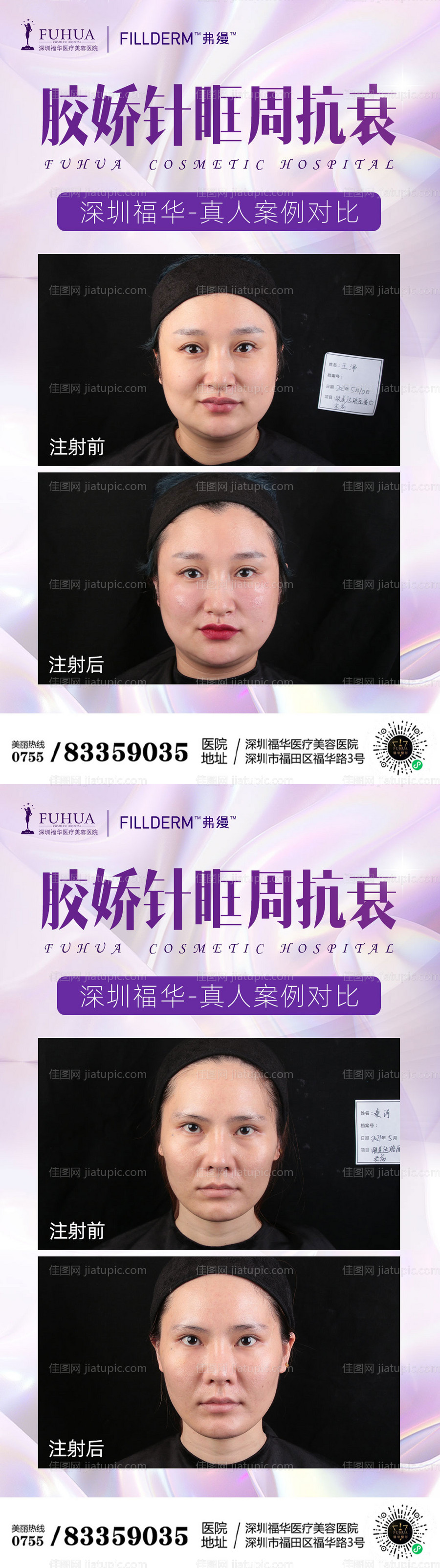 胶娇针案例对比海报-源文件