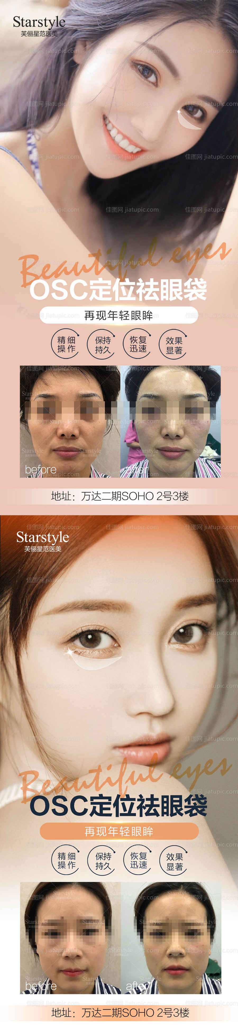 医美祛眼袋人物系列海报-源文件