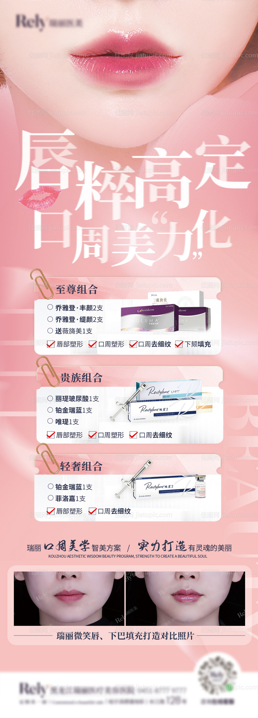 医美乔雅登玻尿酸微笑海报单图 -源文件