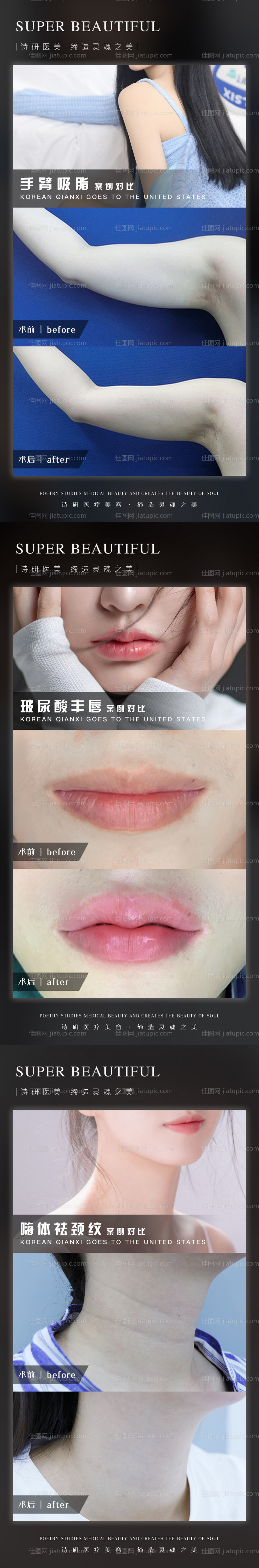 医美案例人物系列海报-源文件