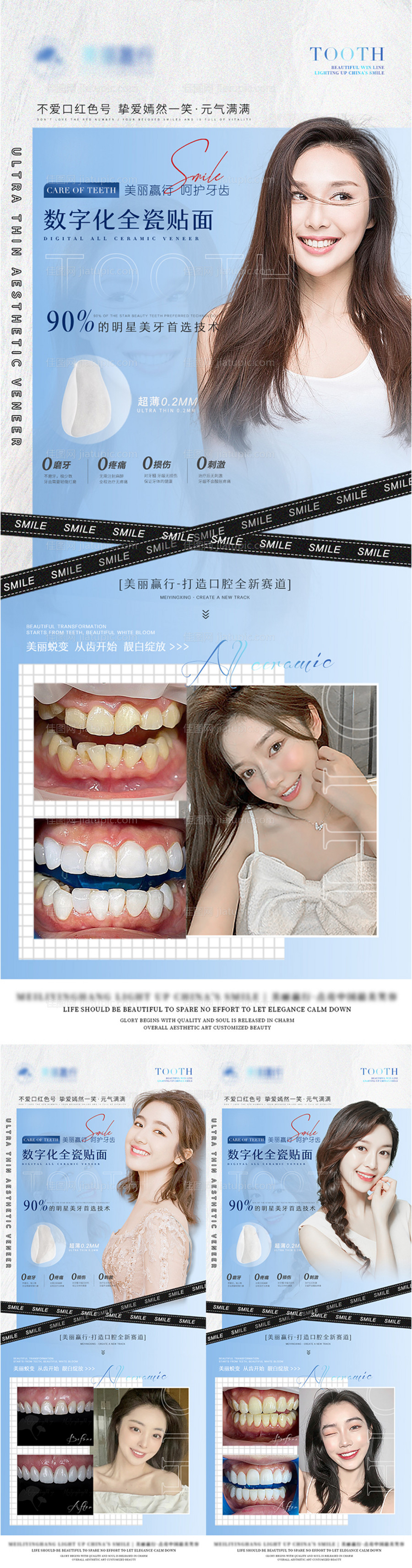 医美牙贴面案例海报-源文件