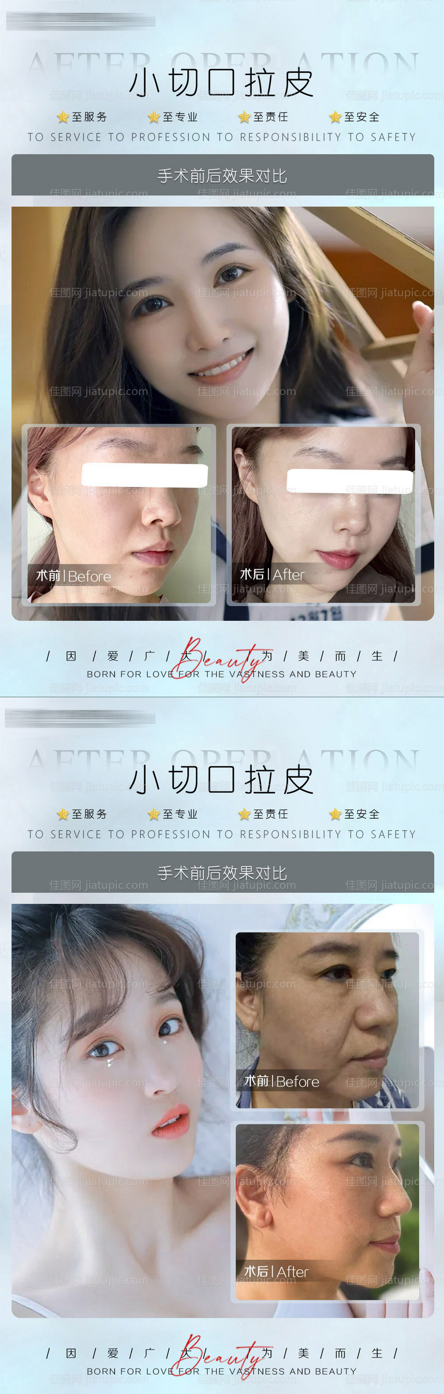 医美真人案例案例对比系列海报-源文件