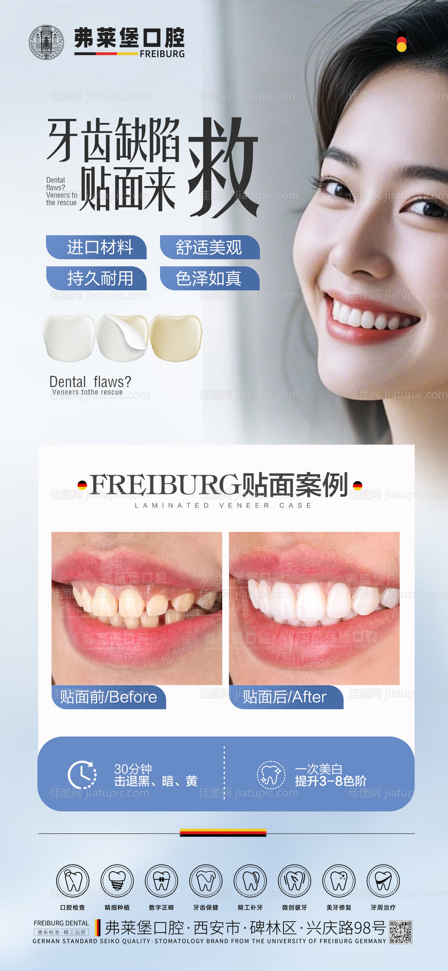 牙齿贴面案例海报-源文件