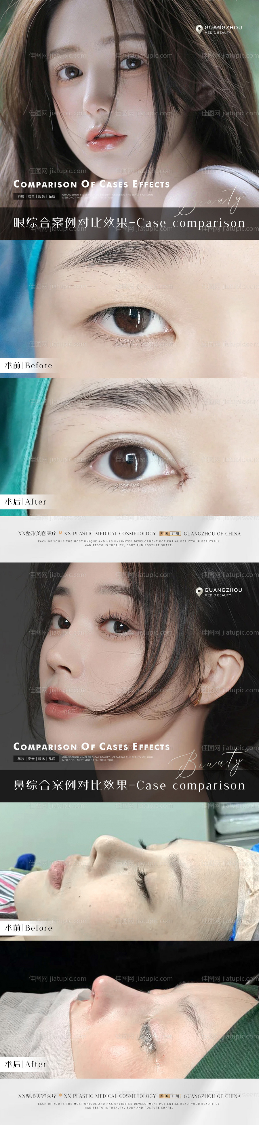 医美案例美眼海报-源文件