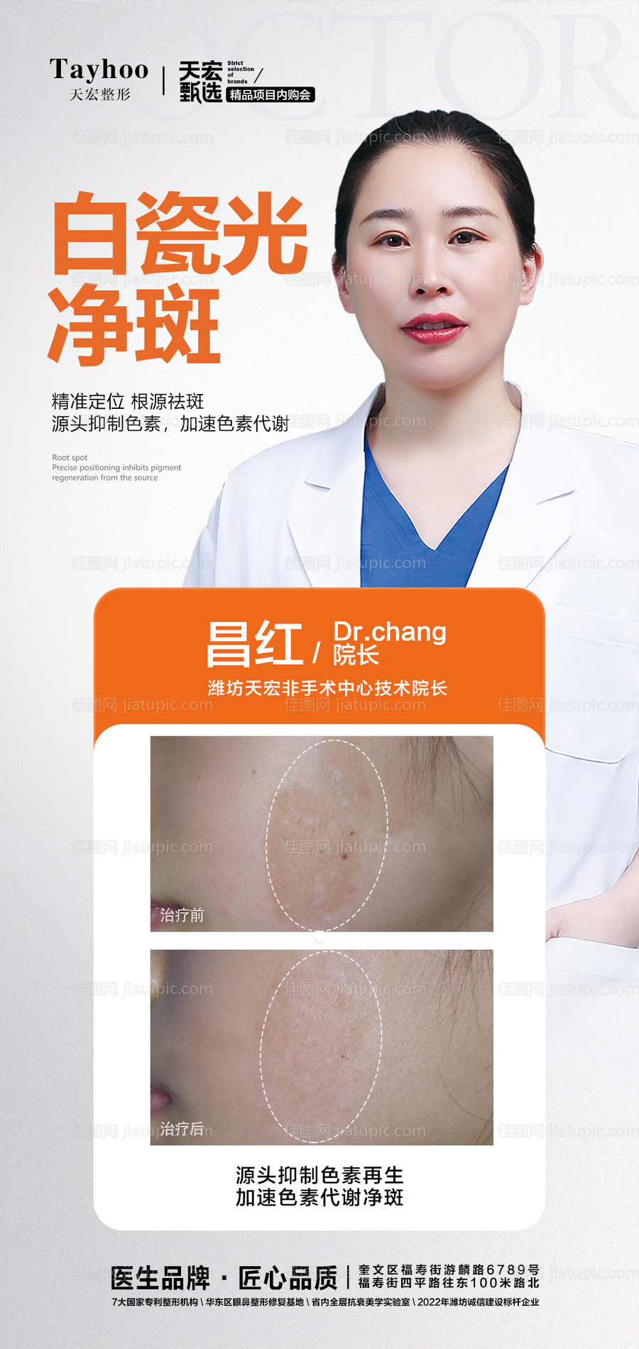 祛斑简约海报-源文件