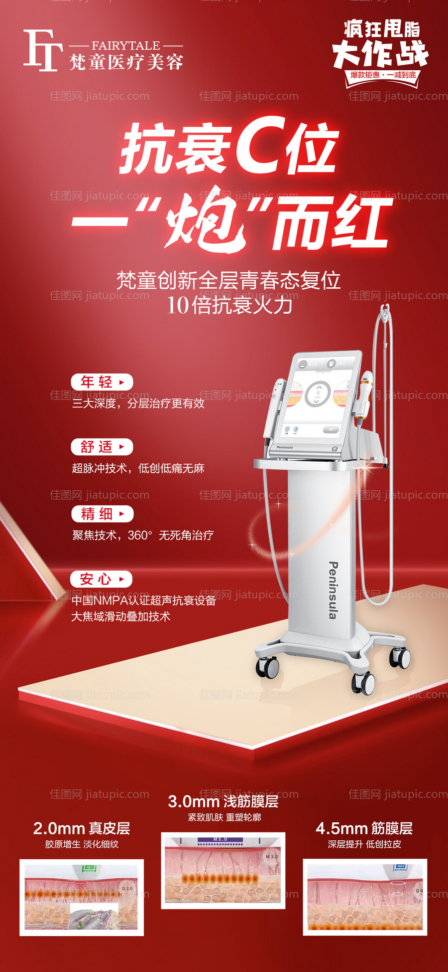 超声炮朋友圈宣传海报-源文件
