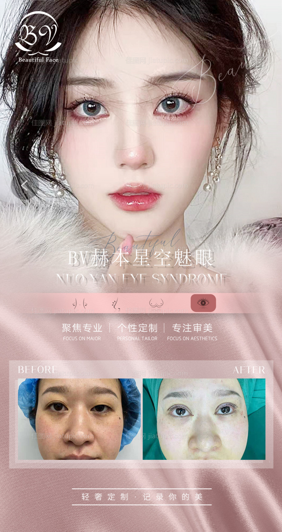 医美眼综合案例海报-源文件