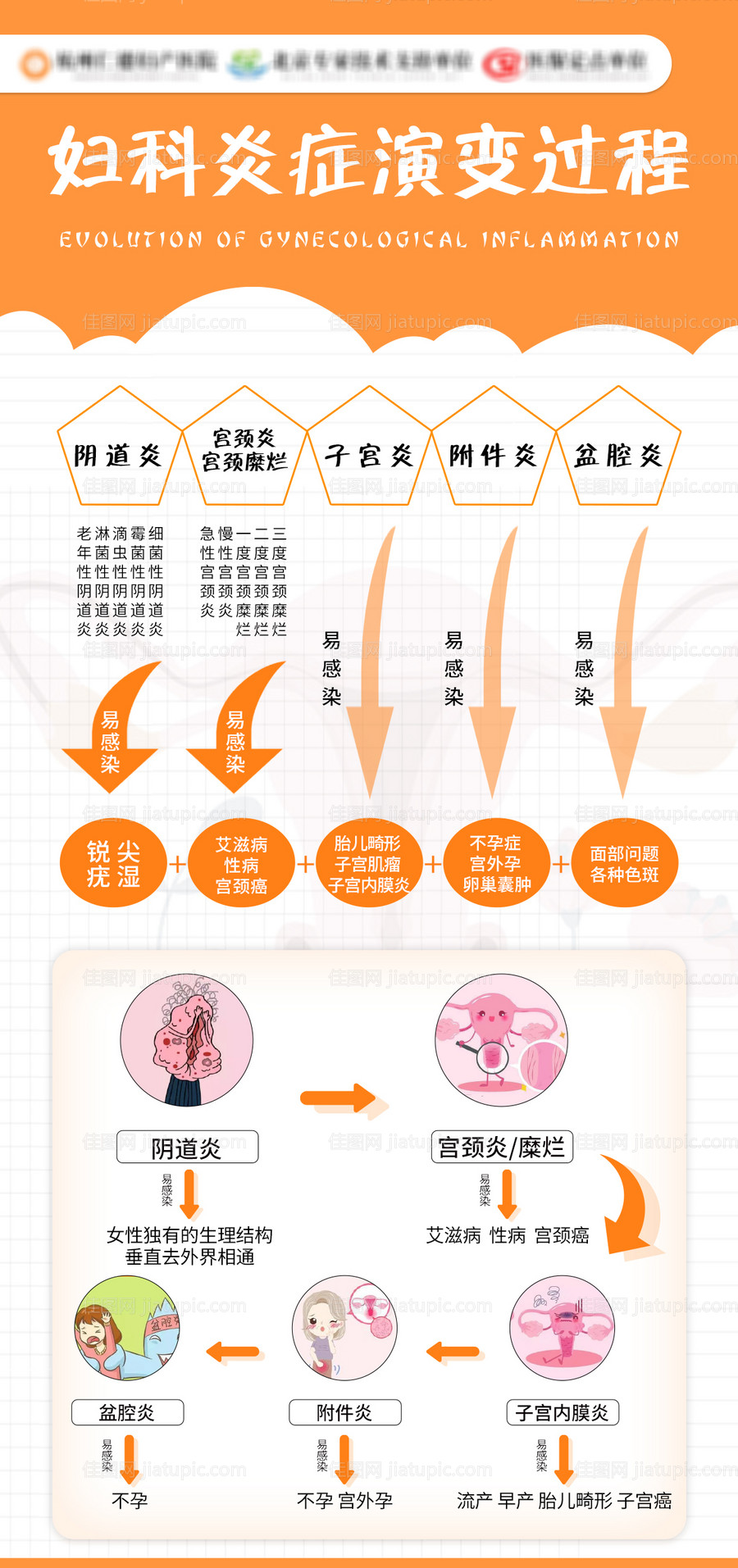 妇科炎症演变过程海报-源文件