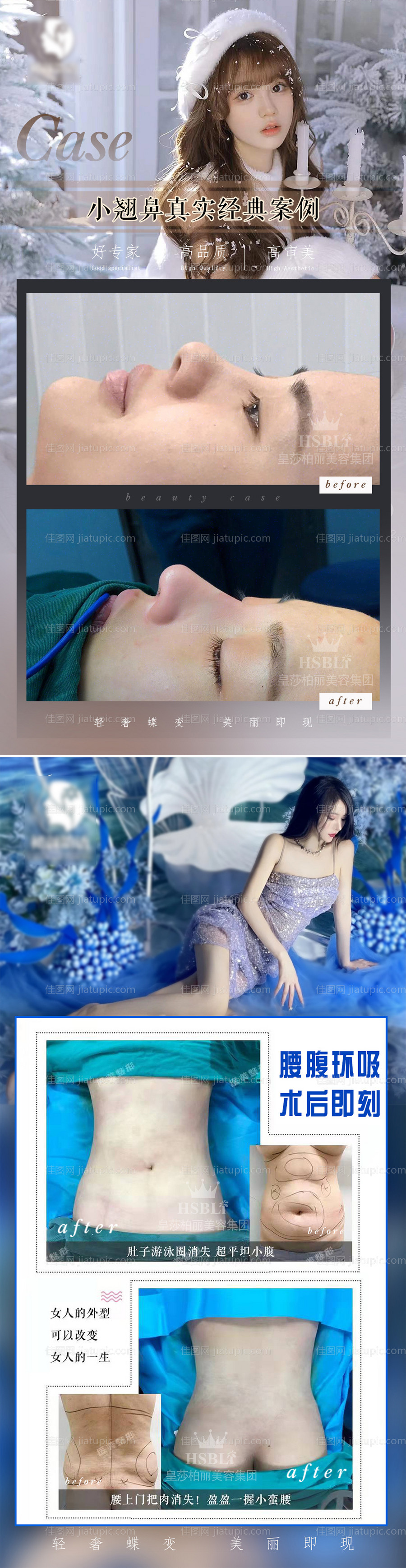 医美案例长图-源文件