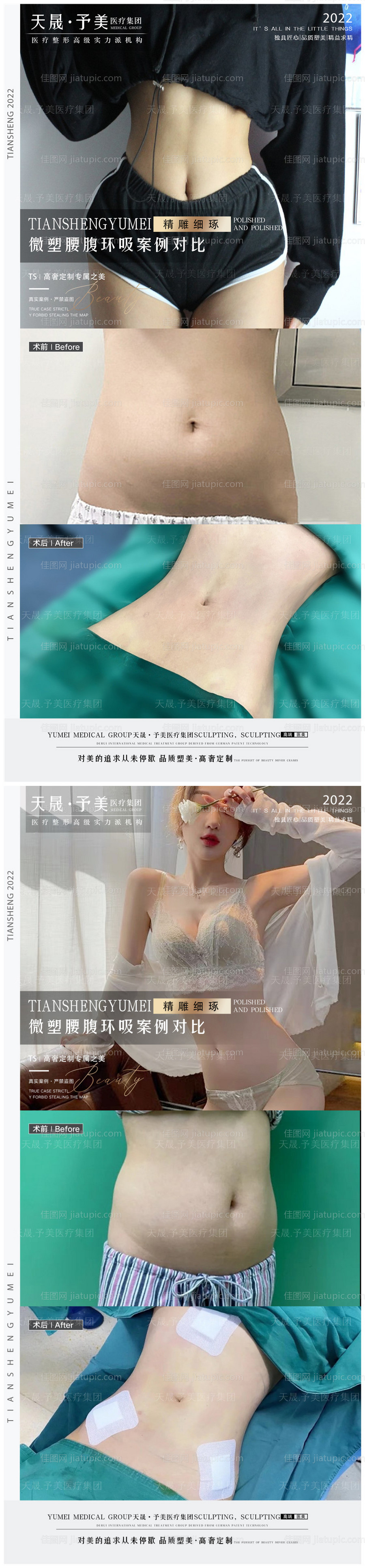 医美案例对比图-源文件
