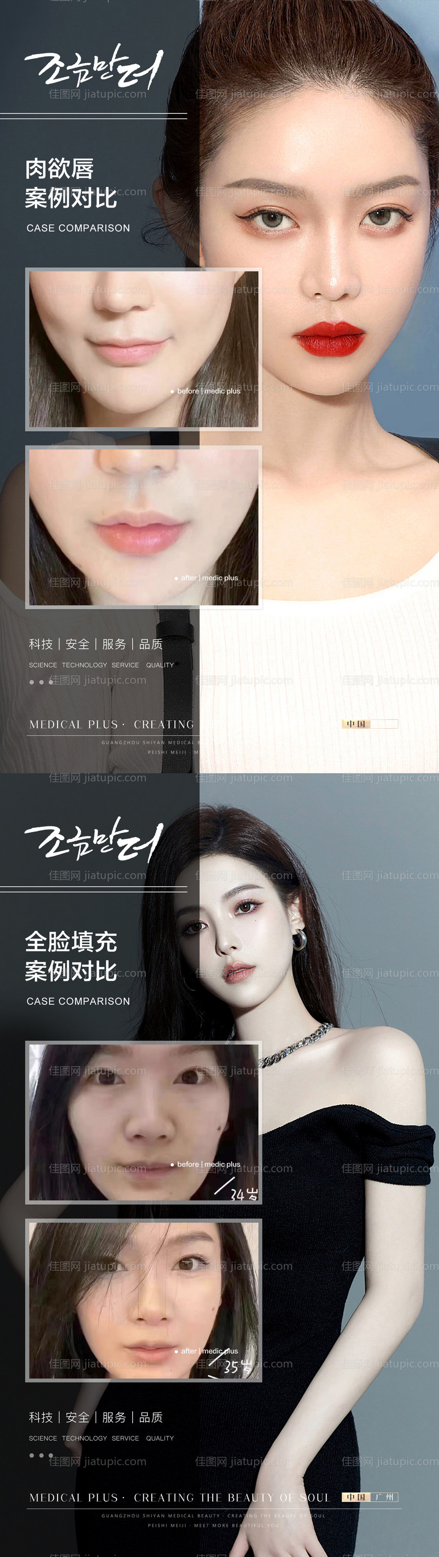 整形真人案例分享集-源文件