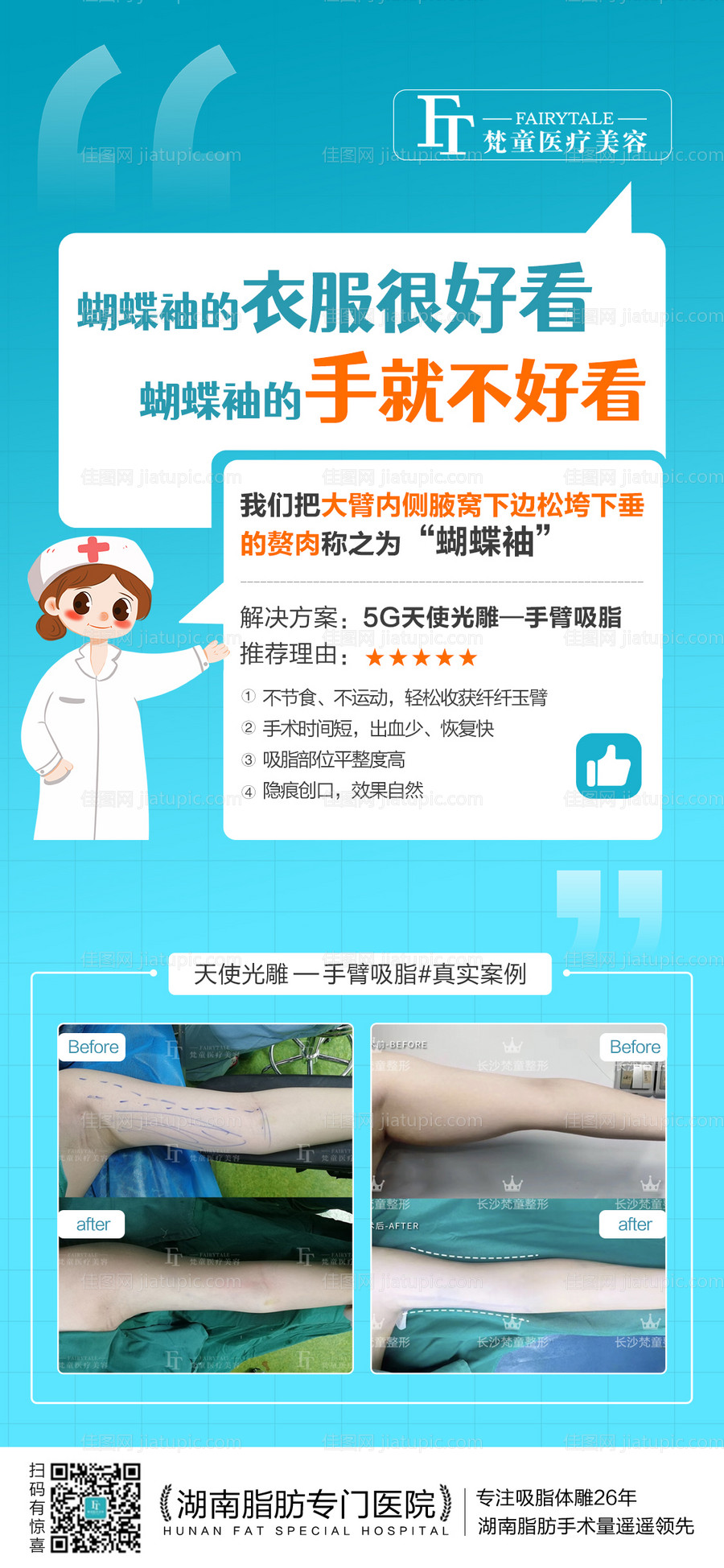 蝴蝶袖手臂吸脂案例海报-源文件