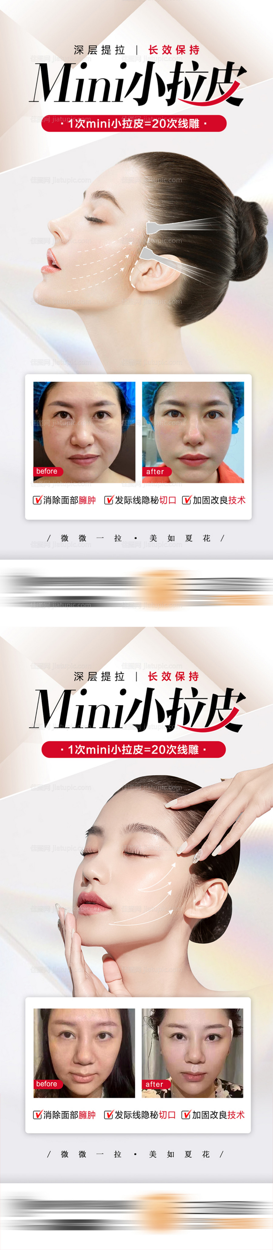 医美整形小拉皮抗衰-源文件