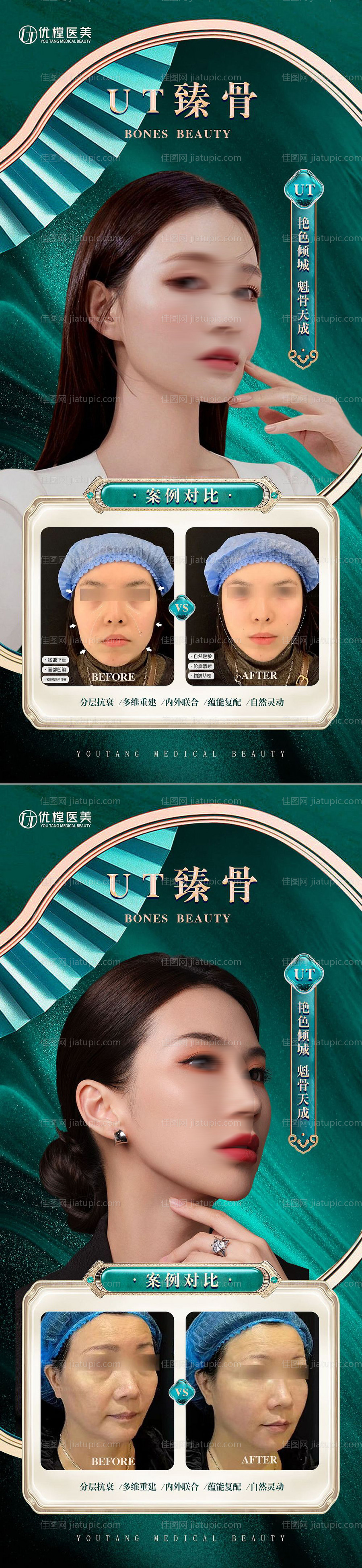 医美案例对比海报-源文件