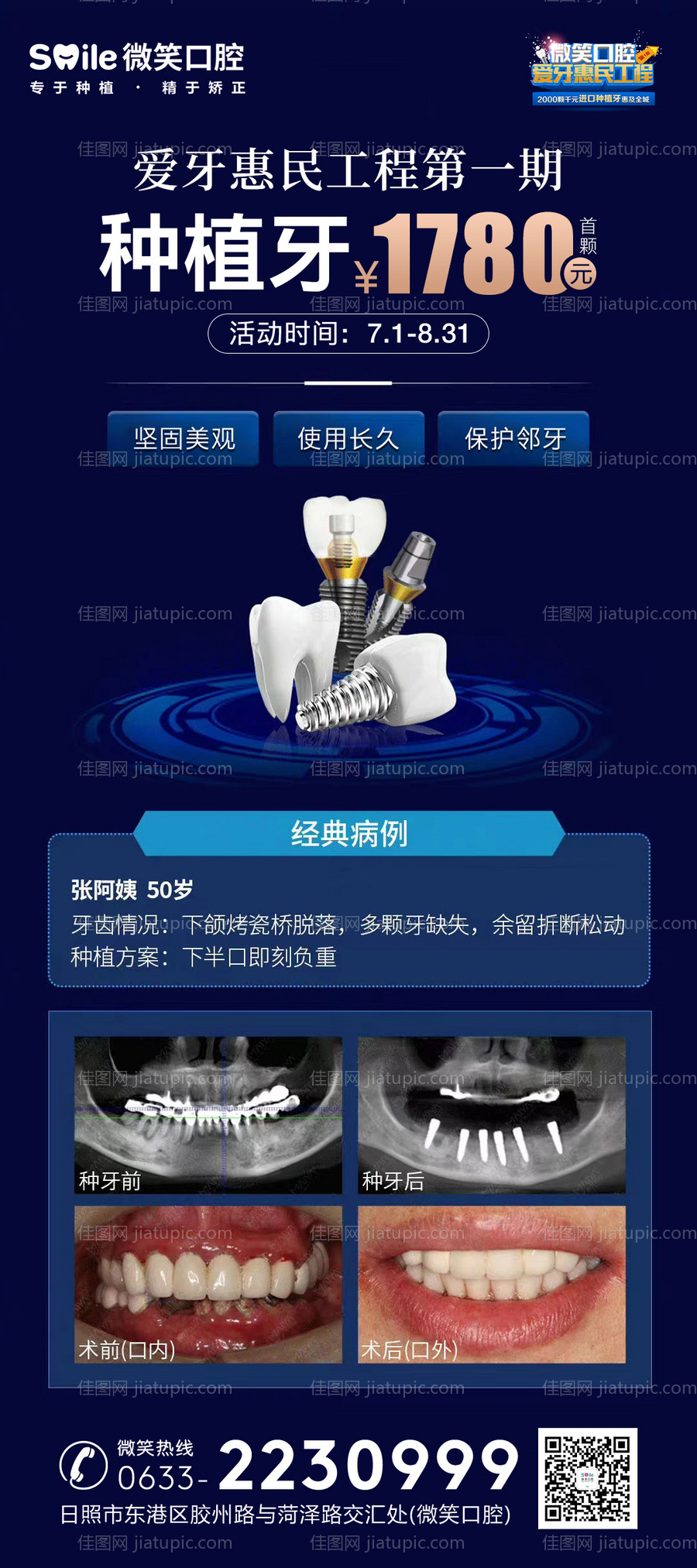 医美口腔种植牙海报-源文件