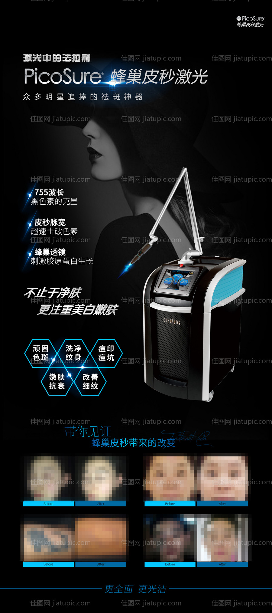 医美整形美容案例对比长图海报-源文件