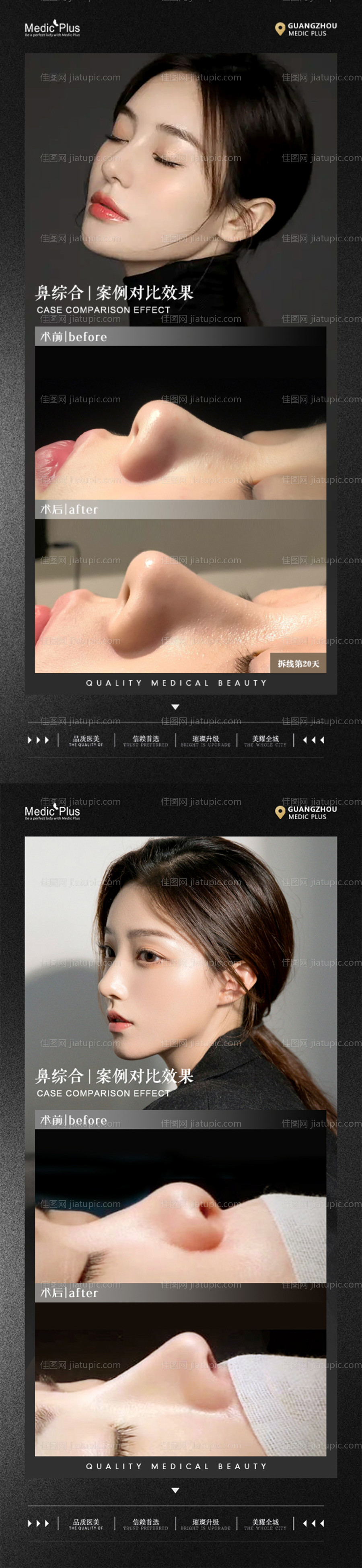 医美案例海报-源文件