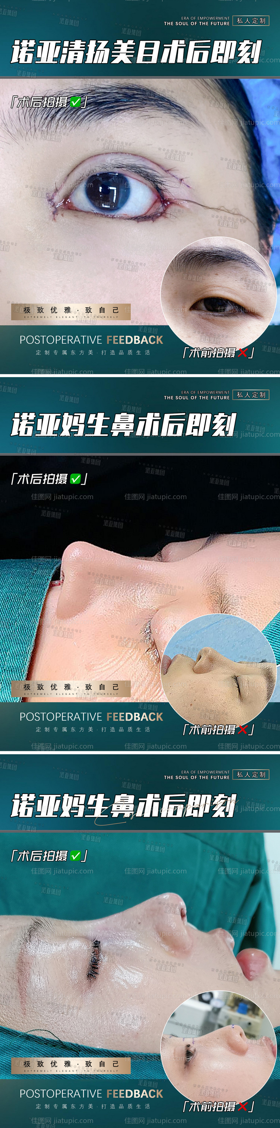 医美整形案例海报-源文件