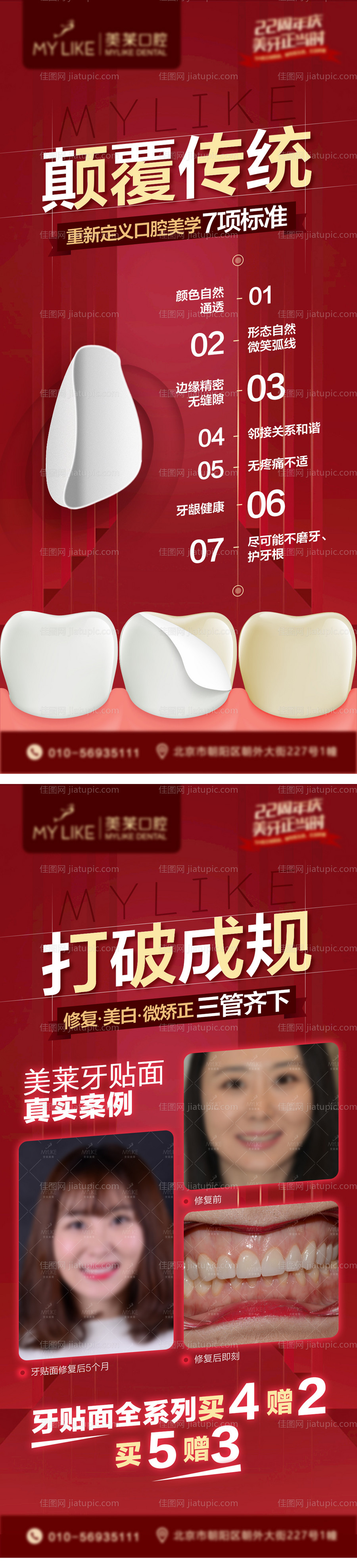 牙贴面朋友圈 口腔海报-源文件