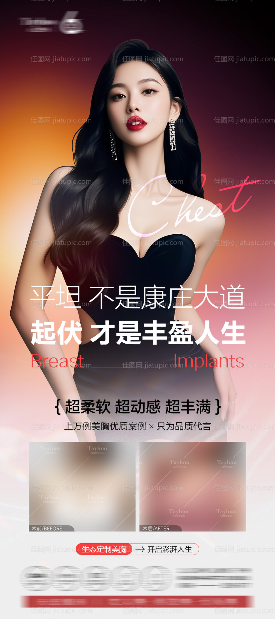 假体隆胸-源文件