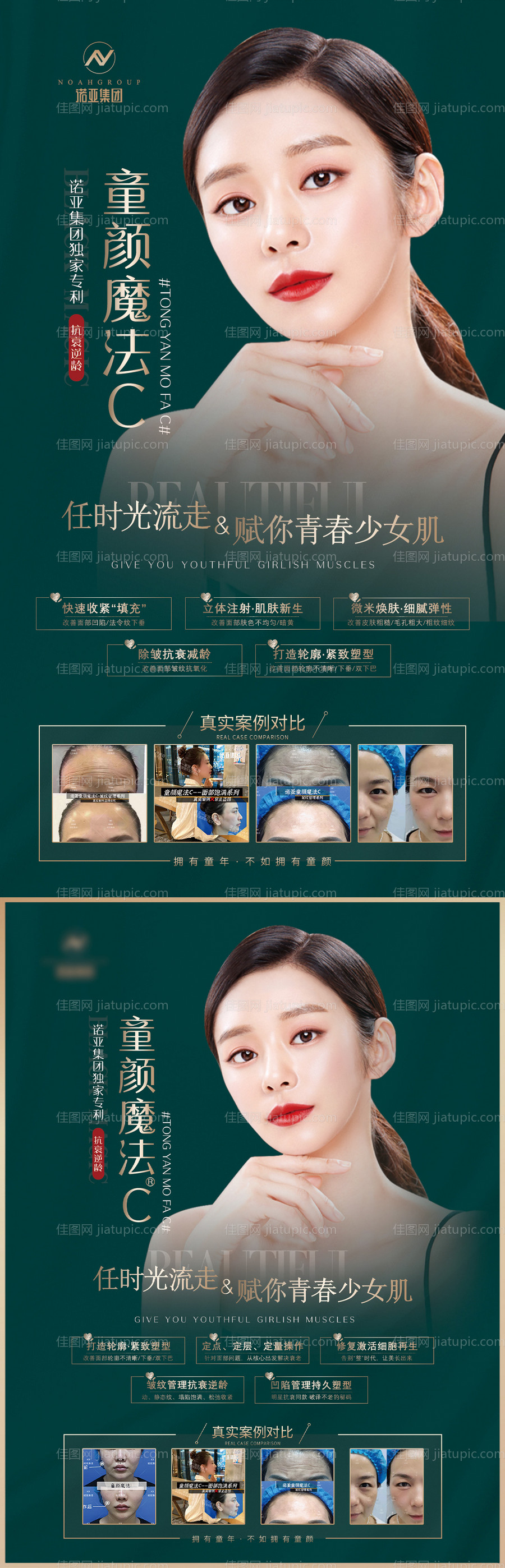 医美项目案例对比系列海报-源文件