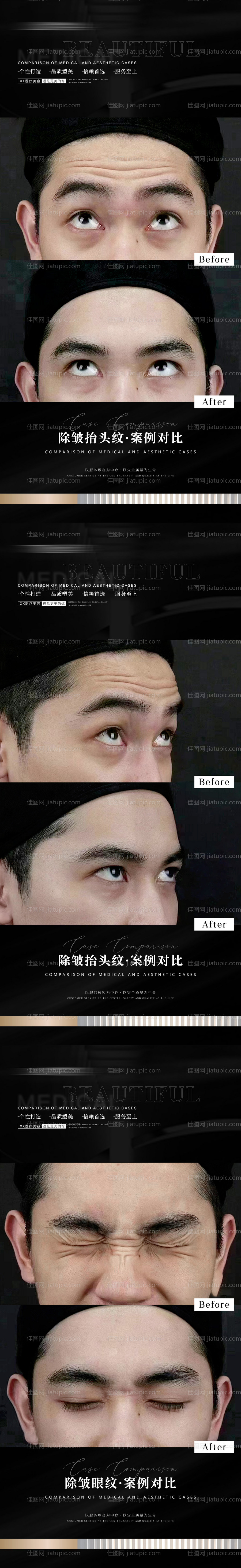 医美案例海报-源文件