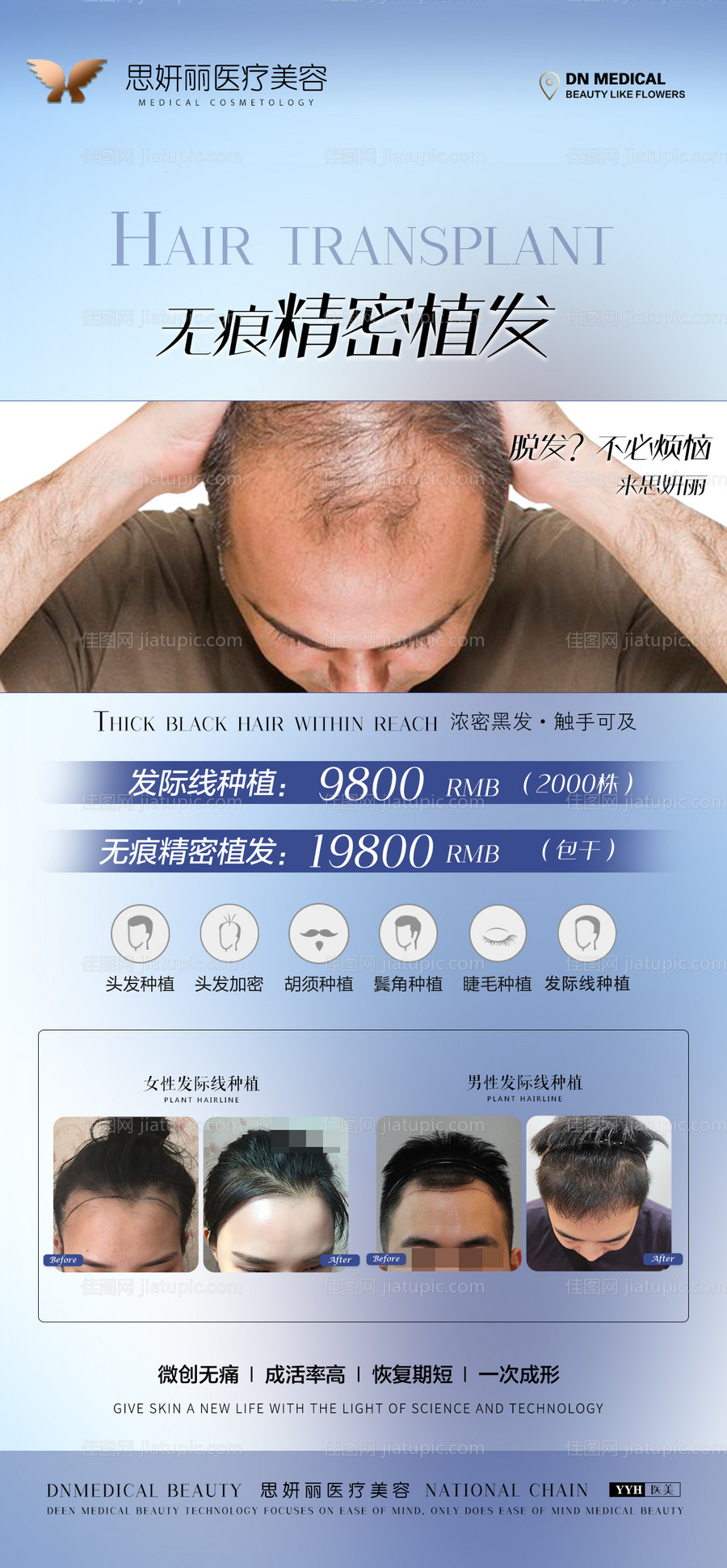 植发发际线种植海报-源文件