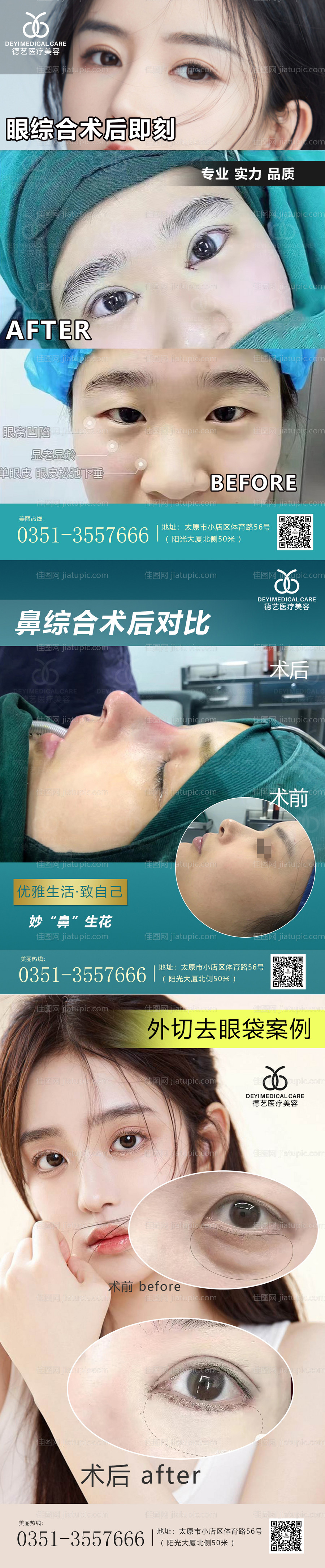 整形真人案例分享集-源文件