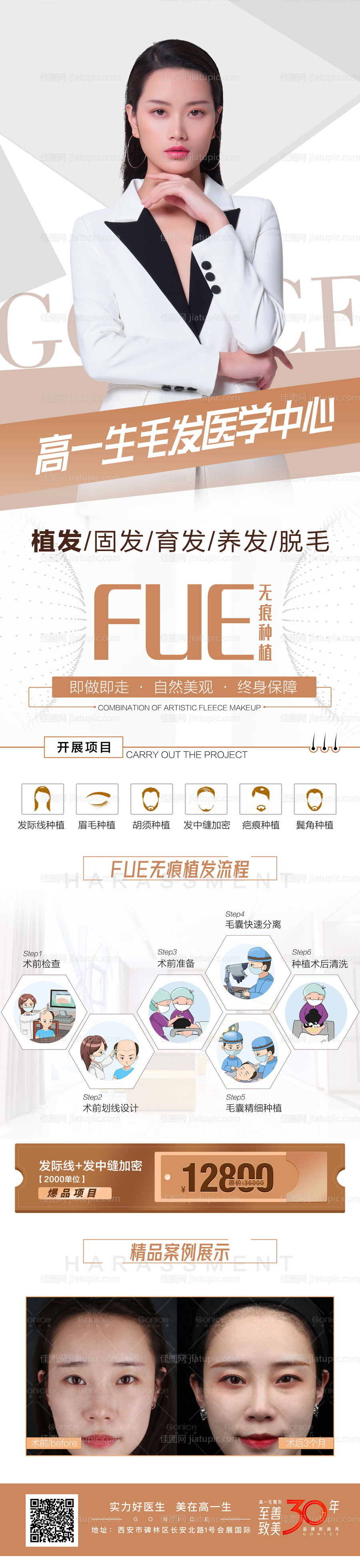 无痕种植-源文件