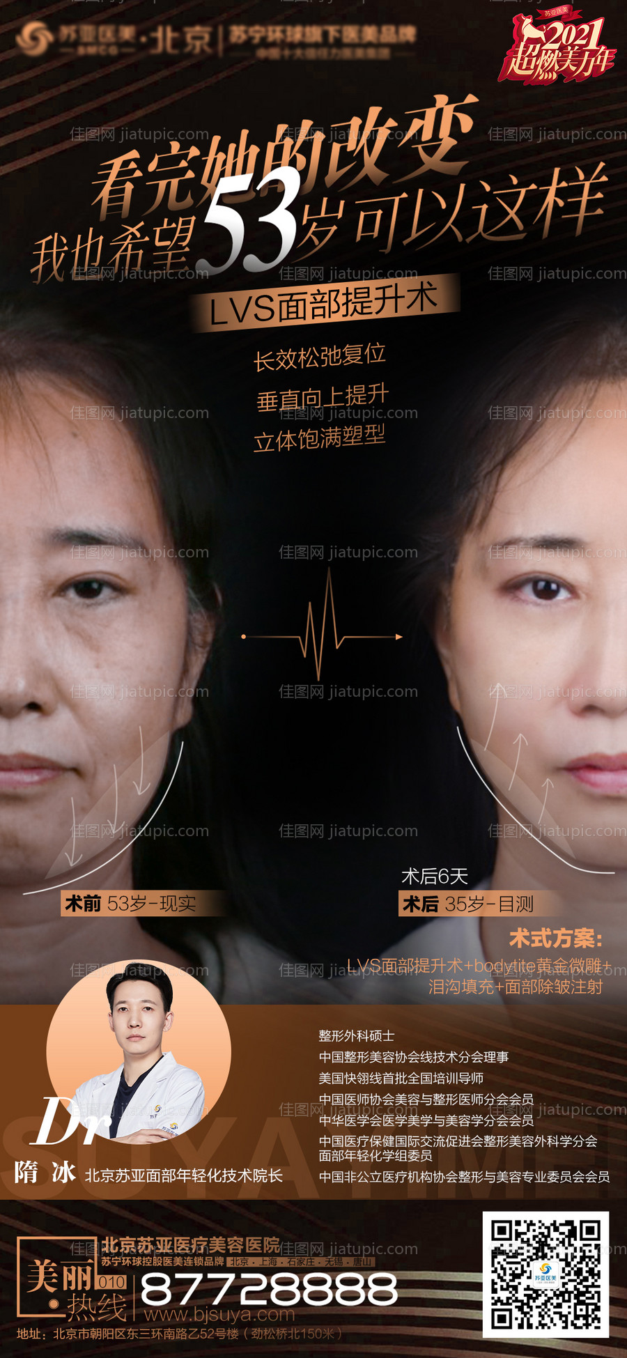 医美线雕提拉小切口案例海报-源文件