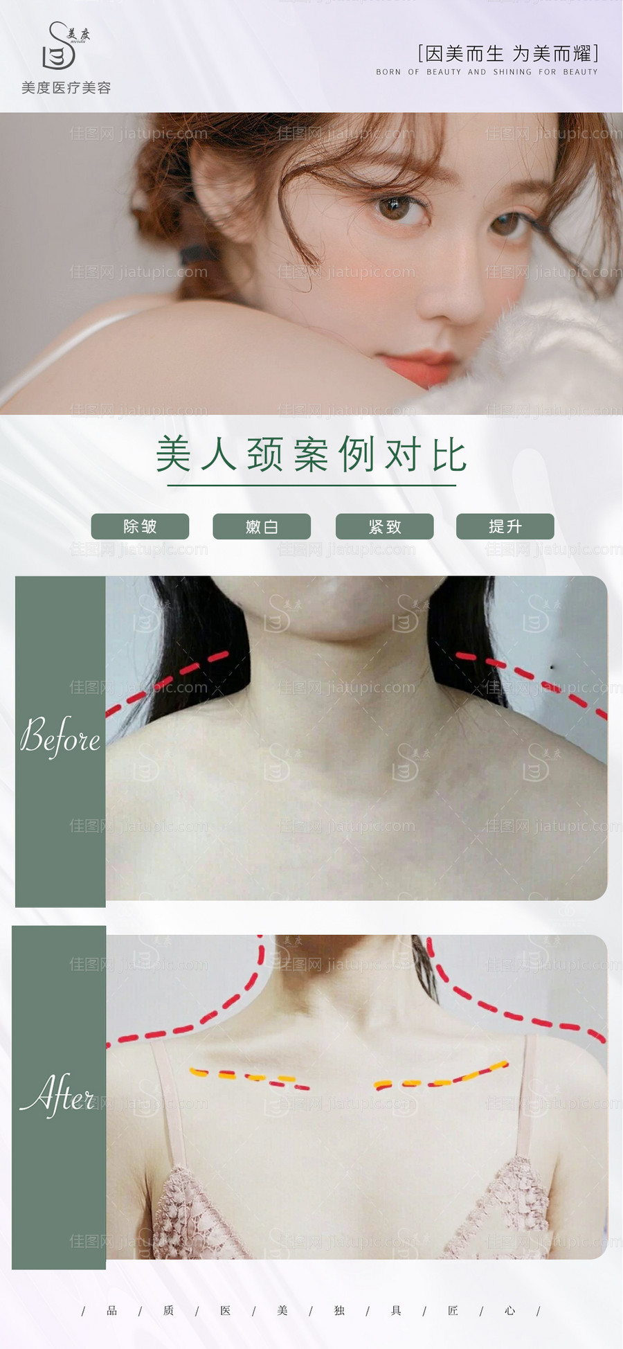 医美案例对比图-源文件