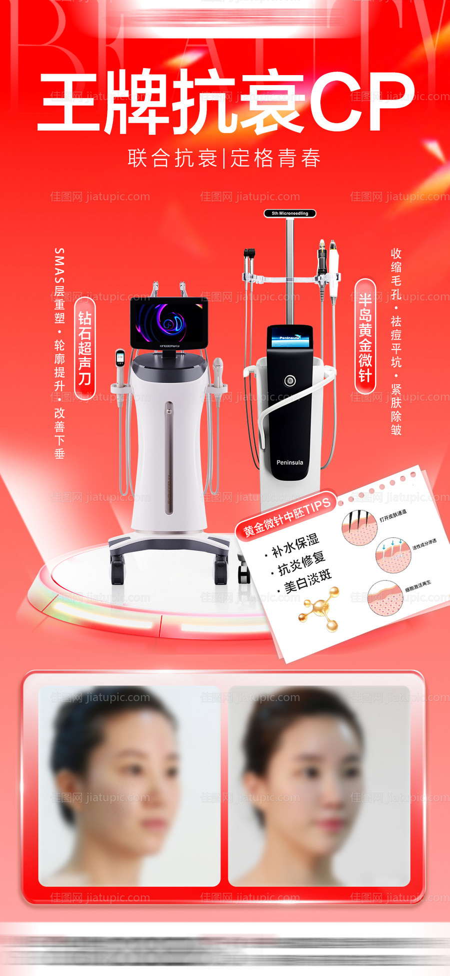 超声刀抗衰案例对比海报-源文件