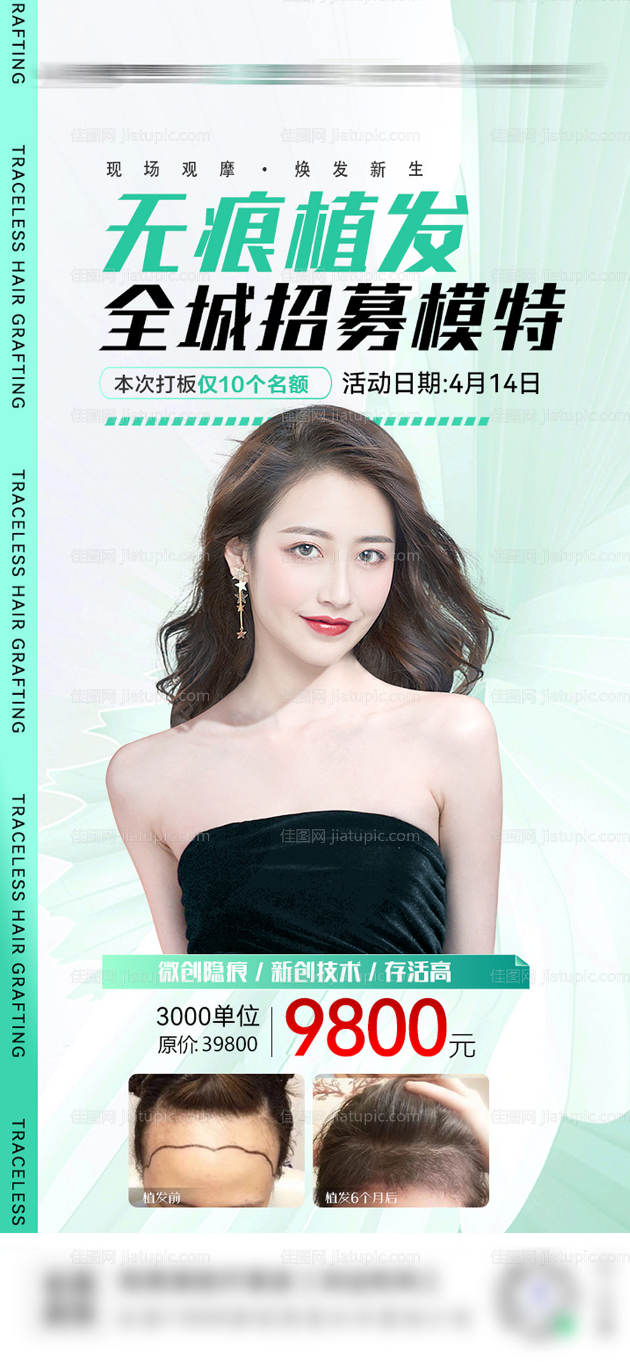 植发模特招募海报-源文件