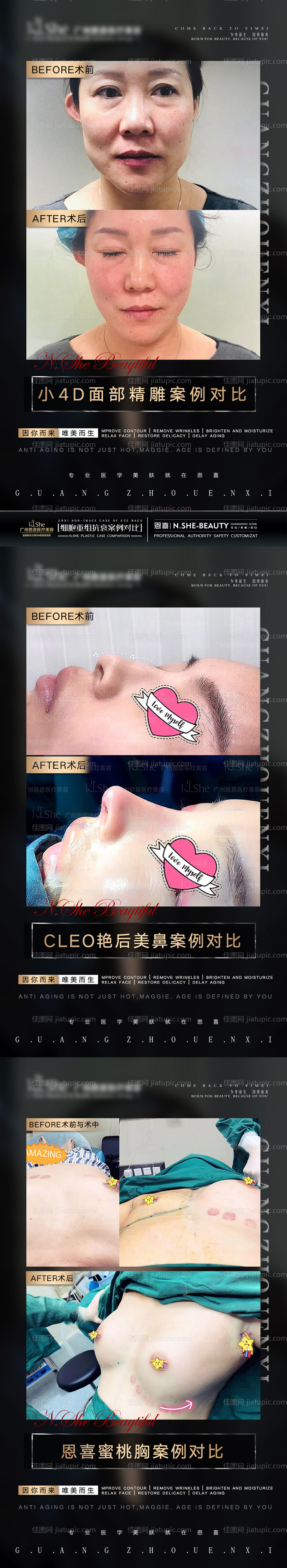 医美案例图-源文件