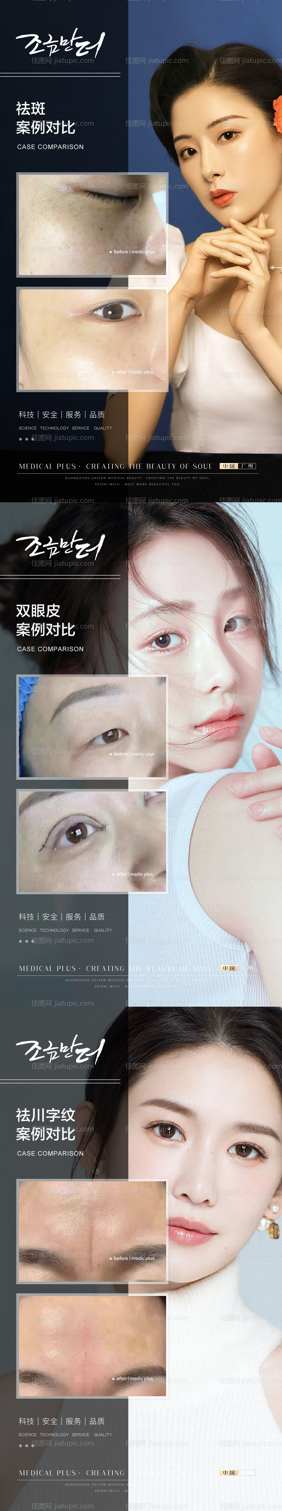 整形真人案例分享集海报-源文件