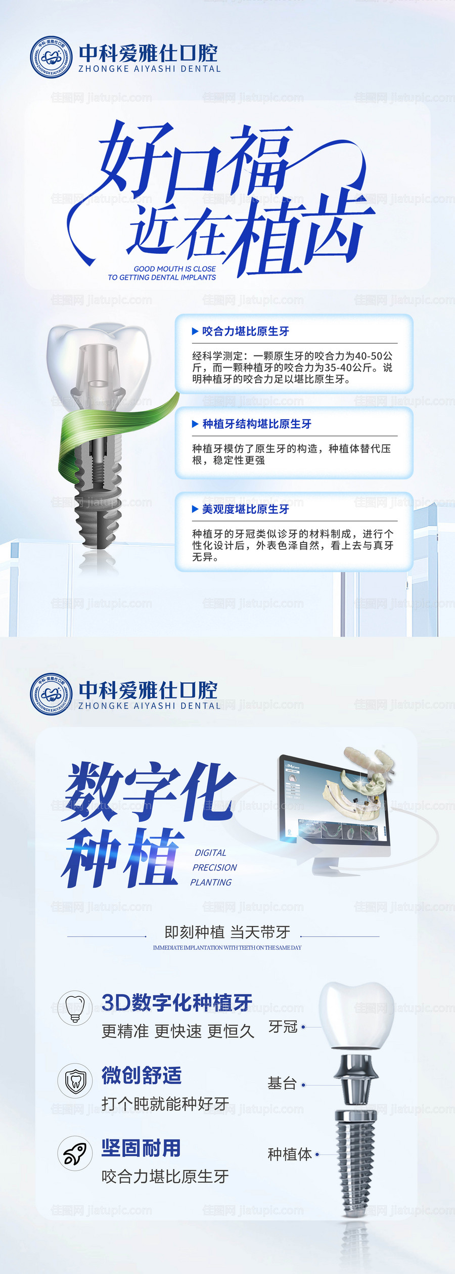 种植牙口腔医院活动海报-源文件