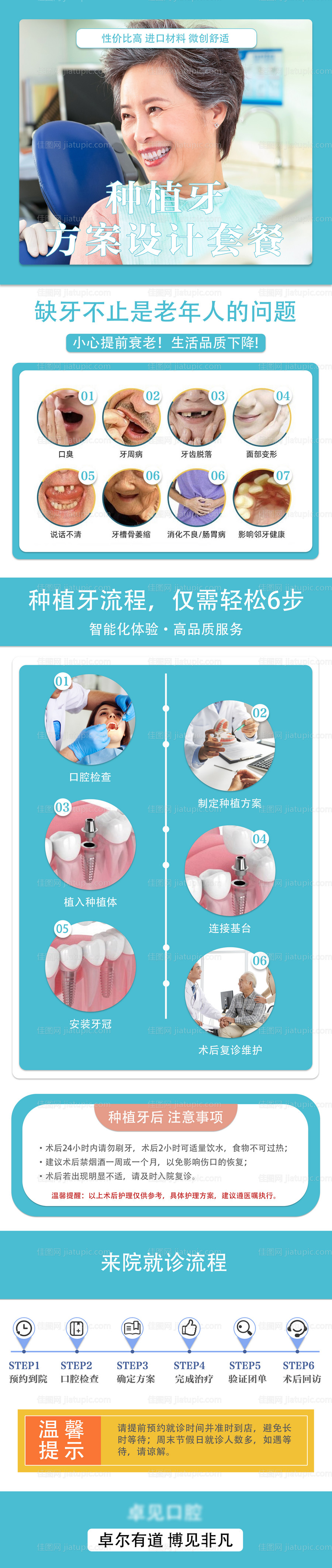 牙科种植牙 -源文件