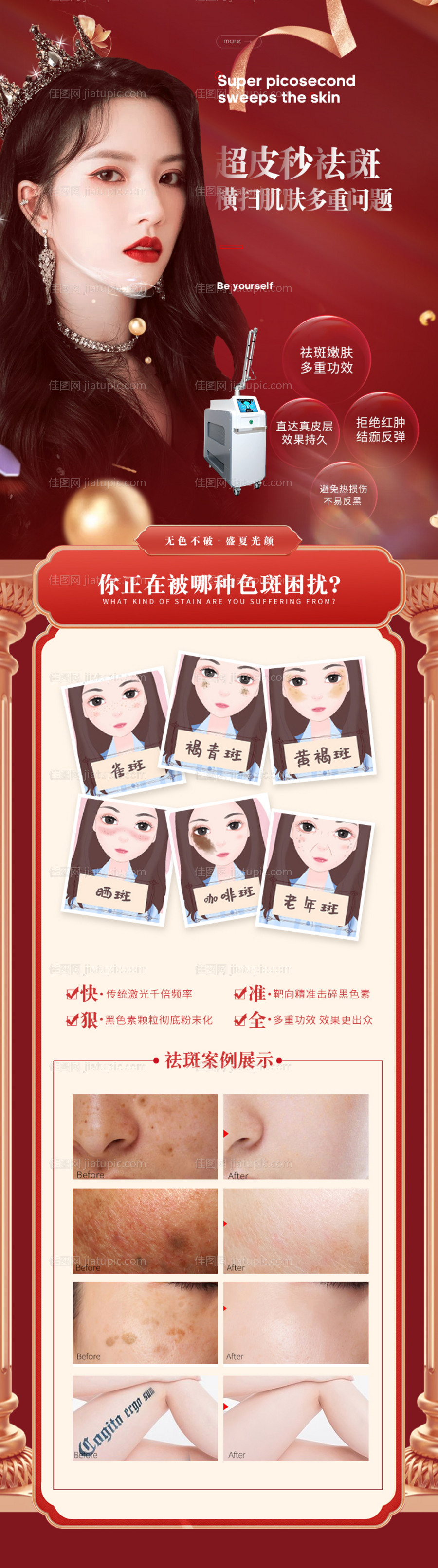 超皮秒祛斑案例海报-源文件